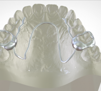 https://img1.yeggi.com/page_images_cache/322238_digital-w-arch-appliance-orthodontic-appliance-by-labmagic-3d-cad