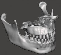 jaw jacker 3D Models to Print - yeggi