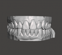 Dental 3d STL archivo 